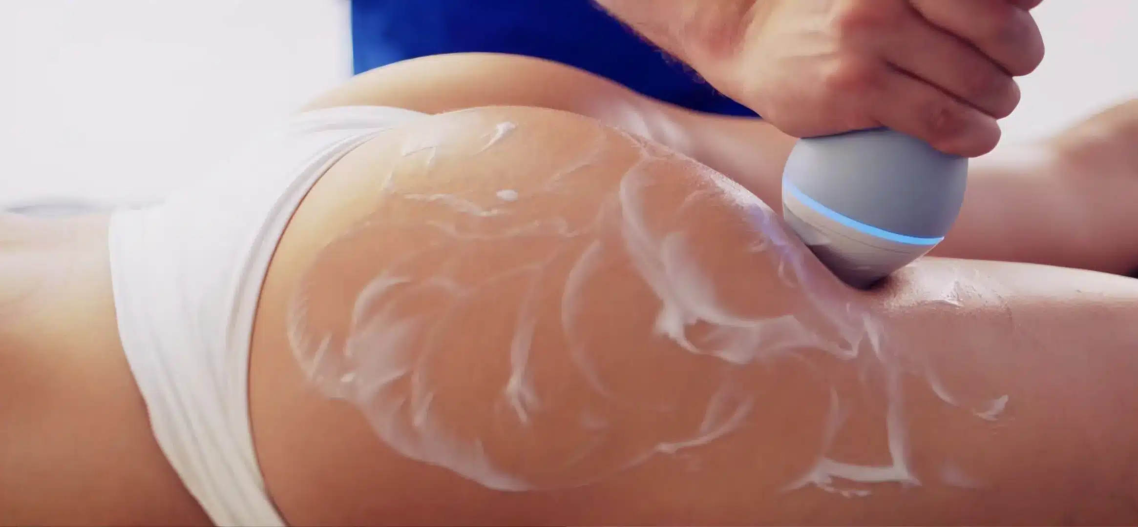 Κυτταρίτιδα - Αντιμετώπιση με EMTONE® 3