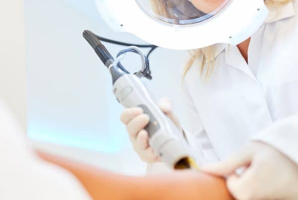 laser αποτρίχωση